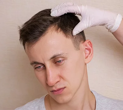 HAIR TRANSPLANT REPAIR