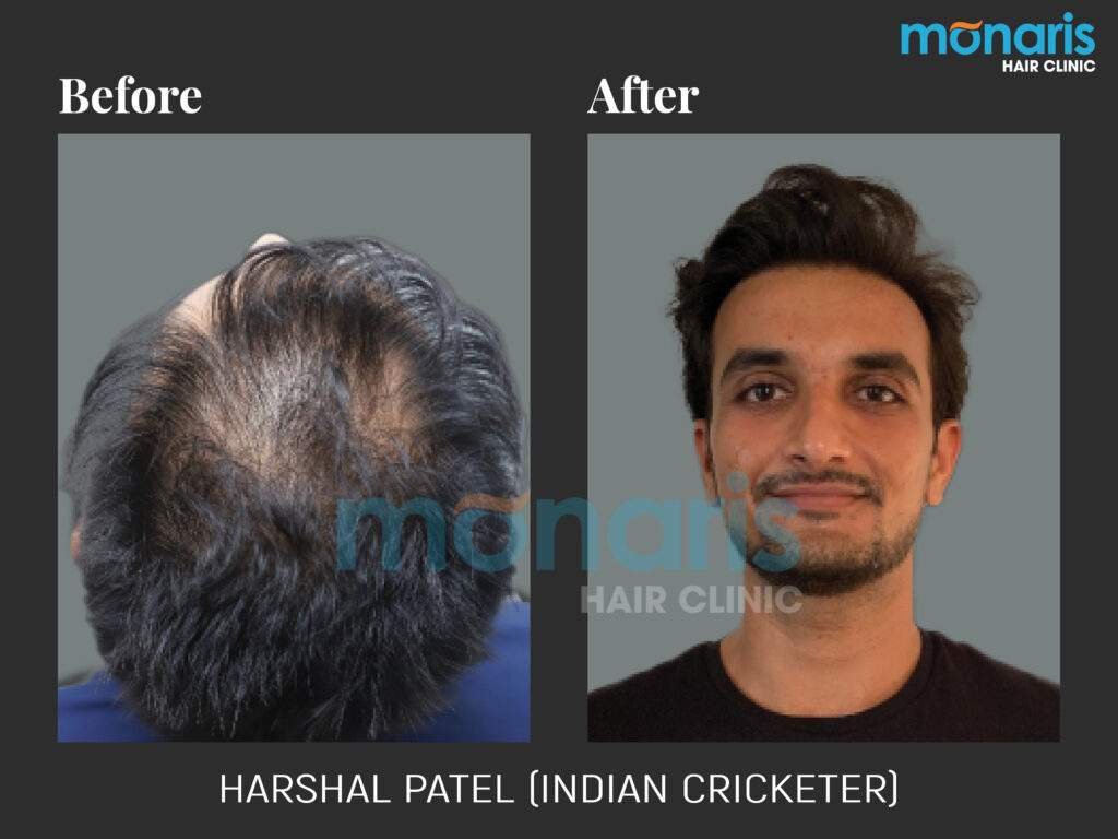 Harshal Patel af be 1