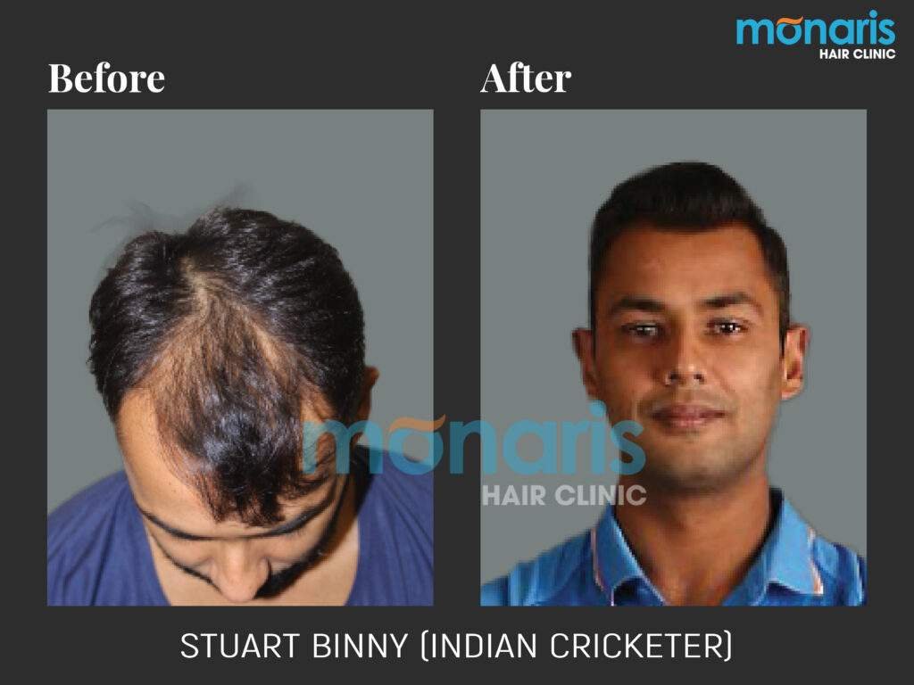 stuart binny af bf 1